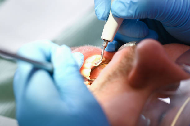 Best Emergency Gum Treatment in Orchards, WA