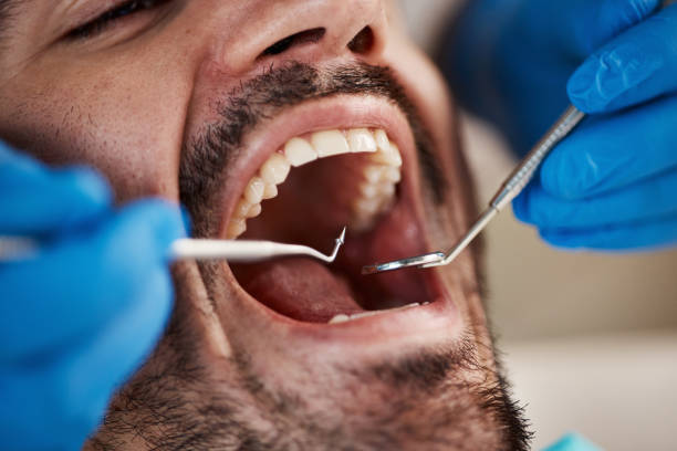 Best Emergency Dental Care for Broken or Chipped Teeth in Orchards, WA